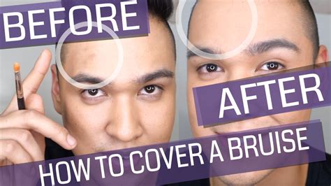 fake bruise|color correcting for bruises.